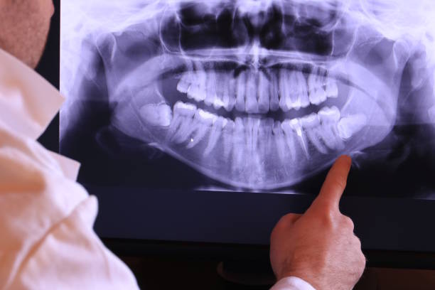 Best Emergency Treatment for Toothache in Las Vegas, NM
