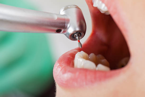 Best Emergency Broken Tooth Repair in Las Vegas, NM